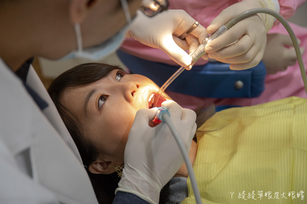 新竹牙醫推薦品味牙醫診所！牙齒冷光美白推薦，我的牙齒美白日記及牙齒居家美白分享